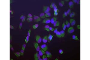 Human HeLa cells stained with ABIN1580459 (red), chicken antibody to vimentin CPCA-Vim (green) and DNA (blue, stained with DAPI). (SF3B4 抗体)