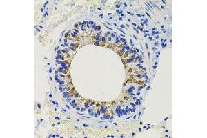 Immunohistochemistry of paraffin-embedded mouse lung using CALB2 antibody (ABIN6003539) at dilution of 1/100 (40x lens). (Calretinin 抗体)