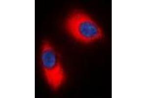 Immunofluorescent analysis of p47 phox staining in Jurkat cells. (NCF1 抗体  (C-Term))
