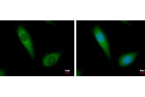 ICC/IF Image NDUFA10 antibody [N1C3] detects NDUFA10 protein at cytoplasm by immunofluorescent analysis. (NDUFA10 抗体  (Center))