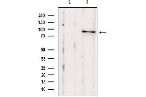 Western blot analysis of extracts from HepG2, using SEC5/EXOC2 antibody. (EXOC2 抗体  (N-Term))
