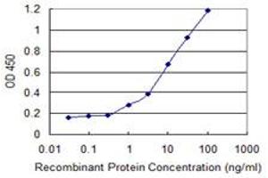 Detection limit for recombinant GST tagged ACTN4 is 0. (alpha Actinin 4 抗体  (AA 592-701))