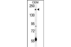 Western blot analysis in CEM cell line lysates (35ug/lane). (TRPM6 抗体  (AA 317-348))