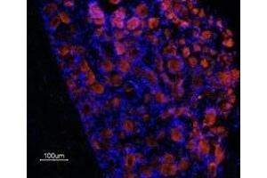 Expression of Prokineticin receptor 1 in rat DRG - Immunohistochemical staining of frozen rat dorsal root ganglion (DRG) sections using Anti-Prokineticin Receptor 1 (extracellular) Antibody (ABIN7043560 and ABIN7045110), (1:100), followed by Alexa-555-conjugated goat anti-rabbit secondary antibody. (Prokineticin Receptor 1 抗体  (Extracellular, N-Term))
