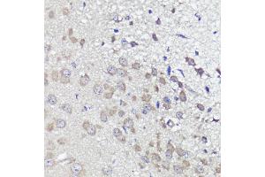 Immunohistochemistry (IHC) image for anti-Ubiquitin-Like 3 (UBL3) (AA 1-117) antibody (ABIN6149849)