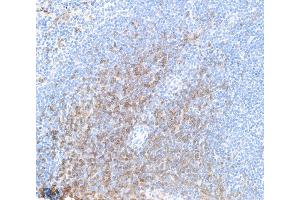 Immunohistochemistry (IHC) image for anti-CD8a Molecule (CD8A) (AA 28-194) antibody (ABIN7453877)