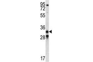 GDF15 antibody western blot analysis in NCI-H460 lysate (GDF15 抗体  (AA 51-79))