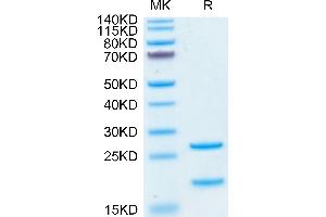 SDS-PAGE (SDS) image for Mannan-Binding Lectin serine Peptidase 2 (MASP2) (AA 288-686) protein (His tag) (ABIN7275292)