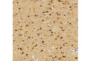 anti-Chromobox Homolog 1 (CBX1) (AA 55-185) antibody