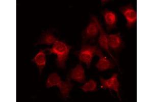 ABIN6272397 staining LOVO by IF/ICC. (POLR3B 抗体  (C-Term))