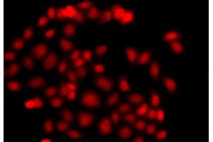 Immunofluorescence analysis of  cells using MLF1 antibody (ABIN6128237, ABIN6143874, ABIN6143876 and ABIN6217281). (MLF1 抗体  (AA 1-268))