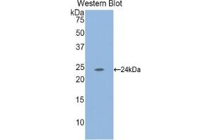 Western blot analysis of the recombinant protein. (Laminin 抗体  (AA 2901-3106))