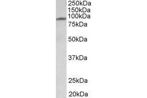Western Blotting (WB) image for anti-Major Facilitator Superfamily Domain Containing 6 (MFSD6) (Internal Region) antibody (ABIN2465065) (MFSD6 抗体  (Internal Region))