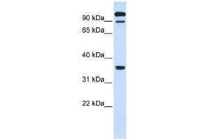 PTPRE antibody used at 1 ug/ml to detect target protein. (PTPRE 抗体  (Middle Region))