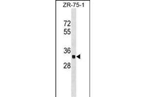 OR2C3 Antibody (C-term) (ABIN1536937 and ABIN2849370) western blot analysis in ZR-75-1 cell line lysates (35 μg/lane). (OR2C3 抗体  (C-Term))