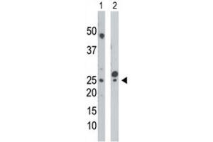 Western Blotting (WB) image for anti-Uridine-Cytidine Kinase (UCK) antibody (ABIN3003699) (UCK 抗体)
