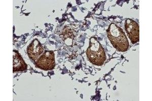 Expression of CB2 receptor in rat dermis - Immunohistochemical staining of paraffin embedded section of rat dermis using Anti-Cannabinoid Receptor 2 Antibody (ABIN7043025, ABIN7044157 and ABIN7044158), (1:100). (CNR2 抗体  (AA 228-242))