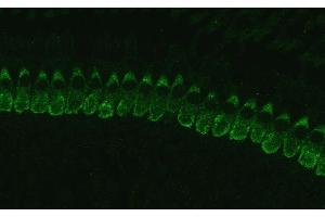 Immunostaining of cochlear inner hair cells (IHCs) from p17 C57black mouse. (Otoferlin 抗体  (Isoform 1))