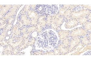 Immunohistochemistry (IHC) image for anti-Lysosomal-Associated Membrane Protein 3 (LAMP3) (AA 222-381) antibody (ABIN7444310)