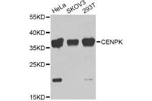 Western blot analysis of extracts of various cell lines, using CENPK Antibody. (CENPK 抗体)