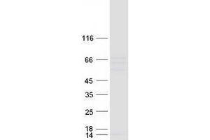 Western Blotting (WB) image for Cholesteryl Ester Transfer Protein (CETP) protein (Myc-DYKDDDDK Tag) (ABIN2713936)