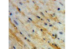 Used in DAB staining on fromalin fixed paraffin-embedded Heart tissue (PCOLCE 抗体  (AA 38-449))