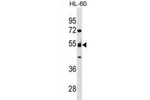 Western Blotting (WB) image for anti-Nucleosome Assembly Protein 1-Like 2 (NAP1L2) antibody (ABIN3000094) (NAP1L2 抗体)