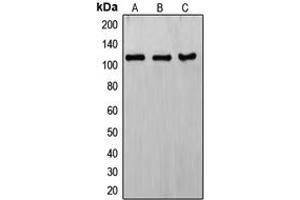 Western blot analysis of ERCC4 expression in HeLa (A), KNRK (B), MCF7 (C) whole cell lysates. (ERCC4 抗体  (C-Term))