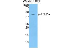 Western blot analysis of the recombinant protein. (BPI 抗体  (AA 320-456))