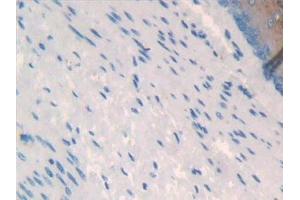 Immunohistochemistry (IHC) image for anti-Glypican 3 (GPC3) (AA 344-559) antibody (ABIN7442228)