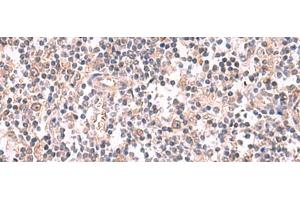 Immunohistochemistry of paraffin-embedded Human tonsil tissue using GSPT2 Polyclonal Antibody at dilution of 1:50(x200) (GSPT2 抗体)