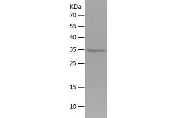 LGR6 Protein (AA 833-967) (His-IF2DI Tag)