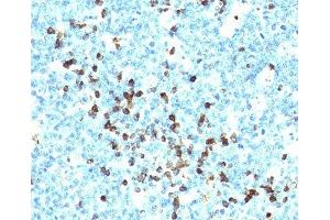 IHC testing of human tonsil stained with Lambda light chain antibody cocktail (LcN-2 + ICO-106). (小鼠 anti-人 lambda Light Chain (Lambda-IgLC) Antibody)