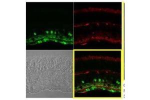 IHC-P Image Immunohistochemical analysis of paraffin-embedded Mouse retina, using Calretinin, antibody at 1:250 dilution. (Calretinin 抗体)