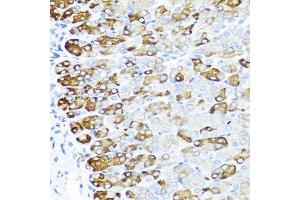 Immunohistochemistry of paraffin-embedded mouse stomach using MGP antibody at dilution of 1:100 (40x lens). (MGP 抗体)