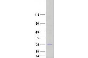 Western Blotting (WB) image for C1q and Tumor Necrosis Factor Related Protein 3 (C1QTNF3) (Transcript Variant 2) protein (Myc-DYKDDDDK Tag) (ABIN2715464)