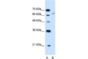 Western Blotting (WB) image for anti-Cystathionine-beta-Synthase (CBS) (N-Term) antibody (ABIN2782348)