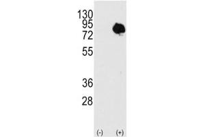 Western Blotting (WB) image for anti-Transglutaminase 2 (C Polypeptide, Protein-Glutamine-gamma-Glutamyltransferase) (TGM2) (AA 413-442) antibody (ABIN3029229)