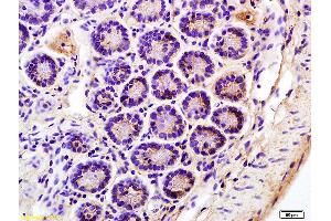 Immunohistochemistry (IHC) image for anti-Killer Cell Immunoglobulin-Like Receptor, Two Domains, Long Cytoplasmic Tail, 3 (KIR2DL3) (AA 42-140) antibody (ABIN748448)