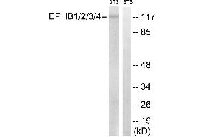 Western blot analysis of extracts from 3T3 cells, treated with heat shock, using EPHB1/2/3/4 (Ab-600/602/614/596) antibody. (EPH Receptor B1/2/3/4 (Tyr600) 抗体)