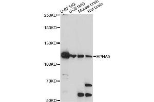 Western blot analysis of extracts of various cell lines, using EPHA5 antibody. (EPH Receptor A5 抗体)