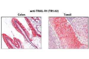 Immunohistochemistry detection of endogenous TRAIL-R1 in paraffin-embedded human carcinoma tissues (colon, tonsil) using mAb to TRAIL-R1 (TR1. (TNFRSF10A 抗体)
