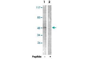 Western blot analysis of extracts from NIH/3T3 cells, using KCNJ3 polyclonal antibody . (KCNJ3 抗体  (Ser185))