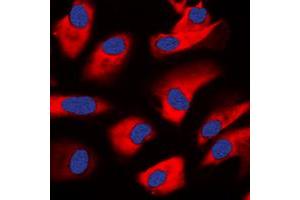 Immunofluorescent analysis of PKC zeta staining in HeLa cells. (PKC zeta 抗体  (C-Term))