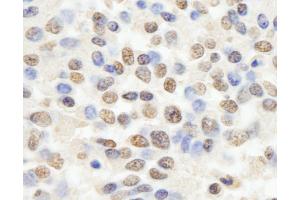 Immunohistochemistry (IHC) image for anti-Retinoblastoma Binding Protein 4 (RBBP4) (AA 1-50) antibody (ABIN7454726)