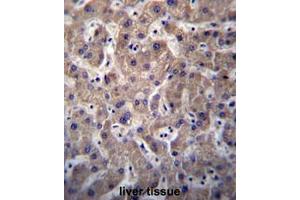 Immunohistochemistry (Paraffin-embedded Sections) (IHC (p)) image for anti-Sulfotransferase Family, Cytosolic, 1C, Member 3 (SULT1C3) (AA 78-107), (C-Term), (N-Term) antibody (ABIN955003)
