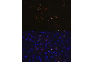 Immunofluorescence (IF) image for anti-Glial Fibrillary Acidic Protein (GFAP) antibody (ABIN7267389)
