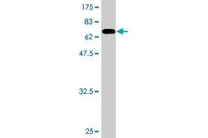 Western Blot detection against Immunogen (73. (PKNOX1 抗体  (AA 1-436))