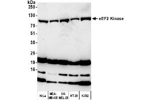anti-Eukaryotic Elongation Factor-2 Kinase (EEF2K) (AA 675-725) antibody