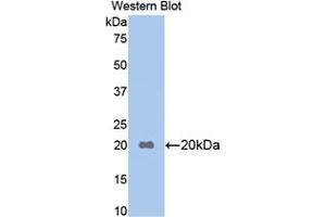 Detection of Recombinant APOB, Mouse using Polyclonal Antibody to Apolipoprotein B (APOB) (APOB 抗体  (AA 3360-3526))